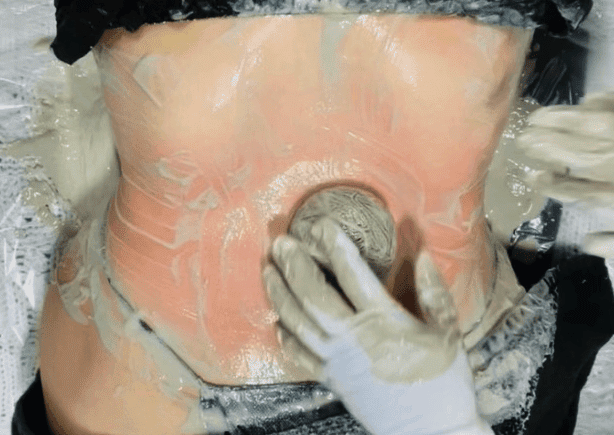 a client is laying down receiving the ice sculpting treatment. Gloved hands are product is all over the skin.